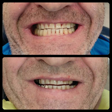 Slider image (4) Dr. Aleksandar Kovacevic - Dental Clinic in Croatia